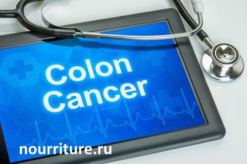 Colon-cancer2.jpg
